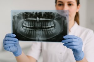 Снимок ОПТГ: заглянуть в глубь вашей улыбки