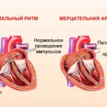аритмия строение сердца