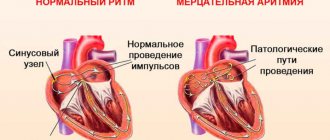 аритмия строение сердца