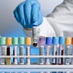 biochemical blood test in St. Petersburg