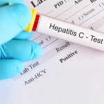 Что такое HCV анализ крови и расшифровка