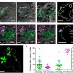 Dynamics of movement of procoagulant platelets in a thrombus