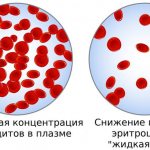 photo: red blood cells in plasma with reduced hematocrit