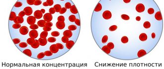 photo: red blood cells in plasma with reduced hematocrit