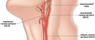 Где находится сонная артерия у человека на шее?