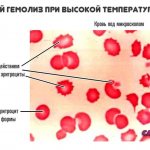death of red blood cells at high temperatures