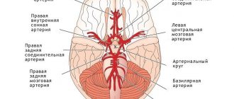 Гипоплазия артерии