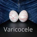 How to determine the appearance of varicocele