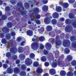 Leukocytes in a blood smear