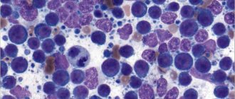 Лейкоциты в мазке крови