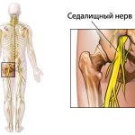 Numbness of skin areas