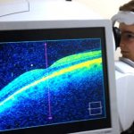 Оптическая когерентная томография в диагностике заболеваний сетчатки глаза