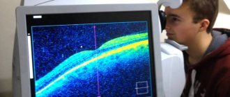 Оптическая когерентная томография в диагностике заболеваний сетчатки глаза