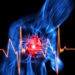 Arrhythmia attack: when the heart asks for help