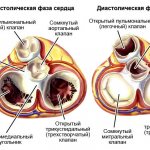 Pulmonary valve of the heart in systolic and diastolic phases