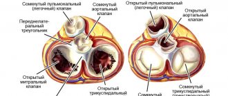 Pulmonary valve of the heart in systolic and diastolic phases