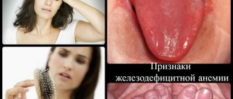 Симптомы железодефицитной анемии