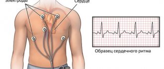 24-hour Holter monitoring