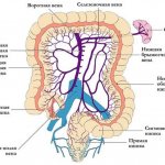 Intestinal thrombosis