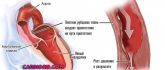 seal-aorta