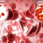 disease anemia