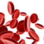 Железодефицитная анемия: причины, профилактика и лечение
